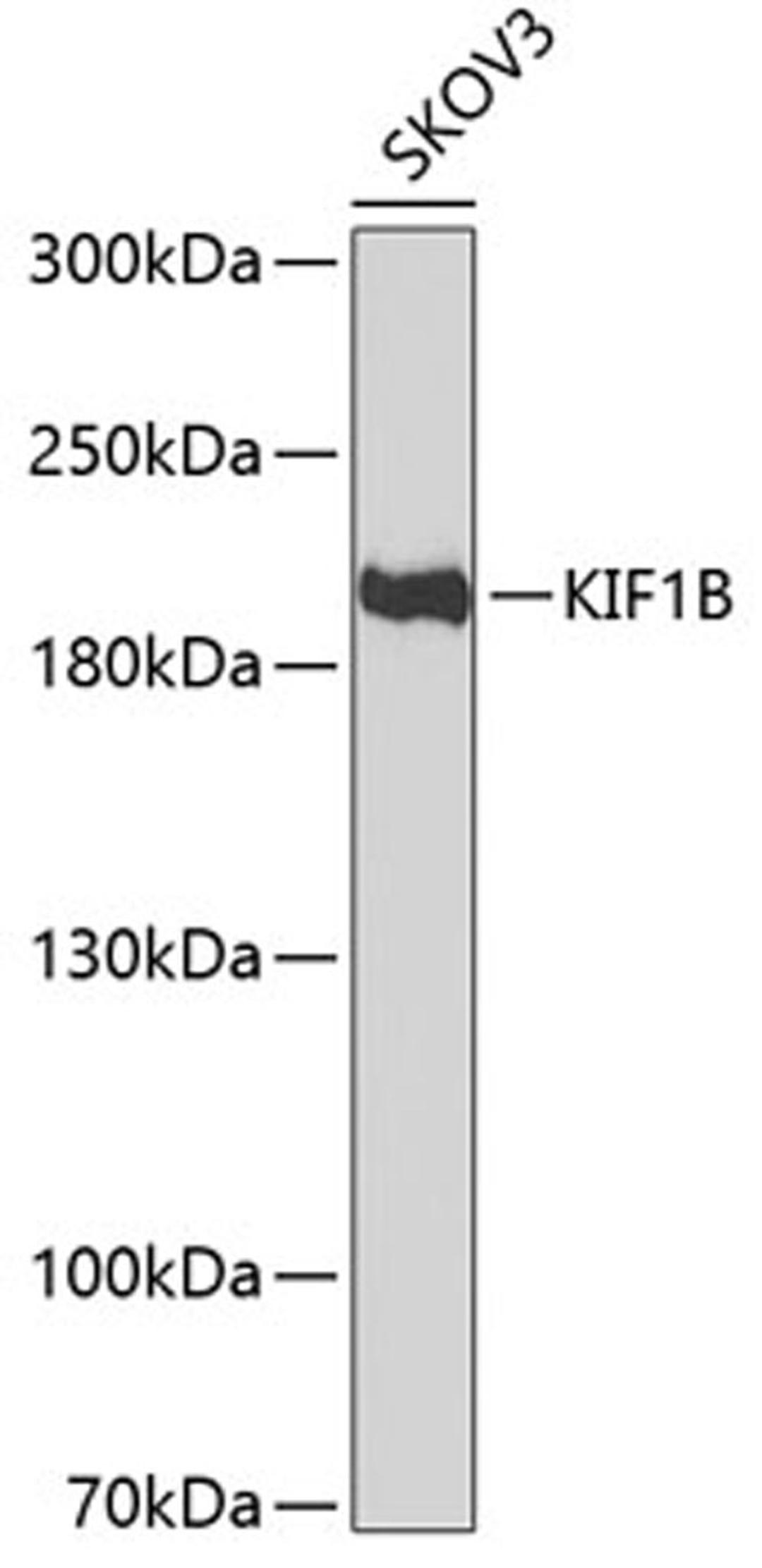 Western blot - KIF1B antibody (A6638)