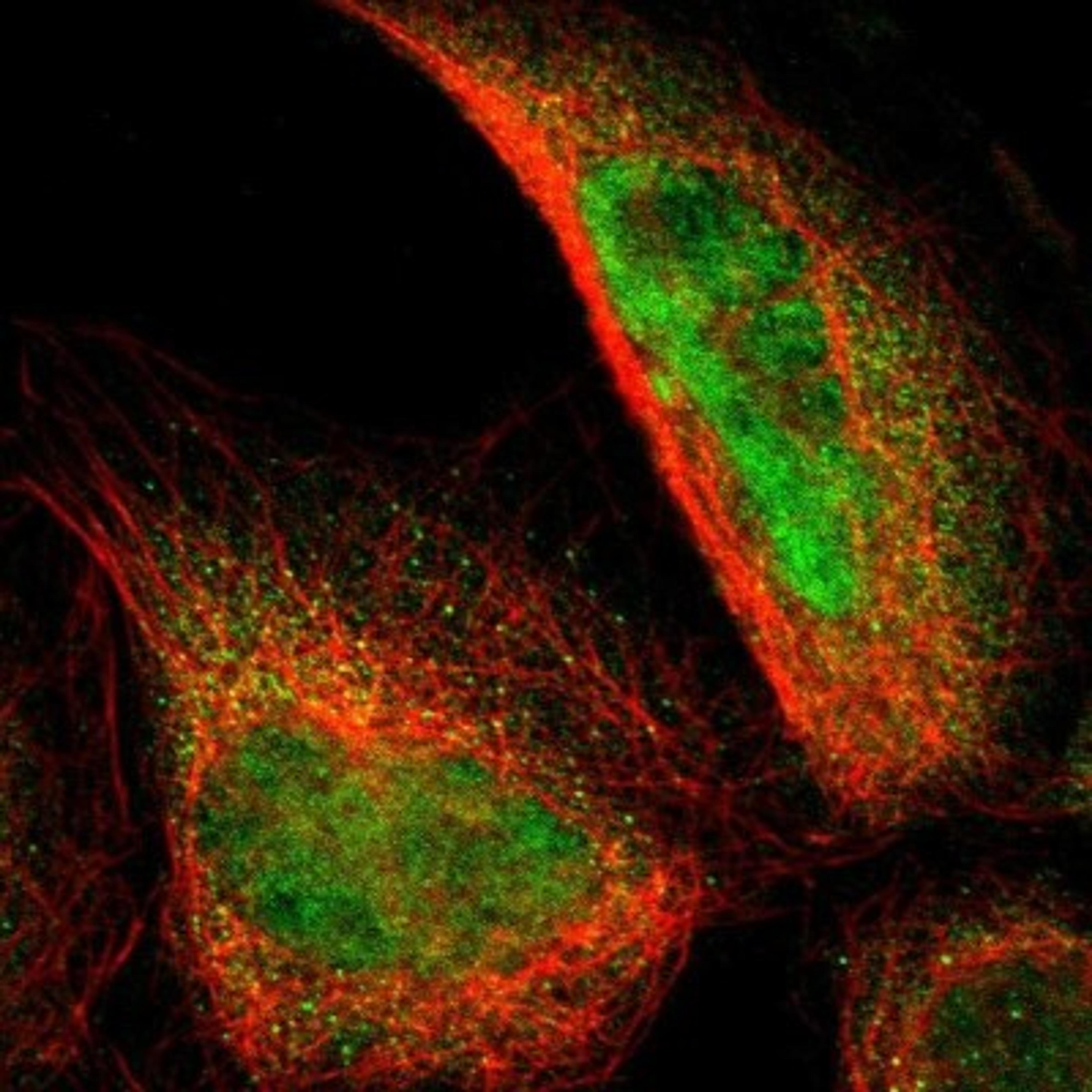 Immunocytochemistry/Immunofluorescence: RRP7A Antibody [NBP1-85647] - Immunofluorescent staining of human cell line A-431 shows positivity in nucleus & cytoplasm.