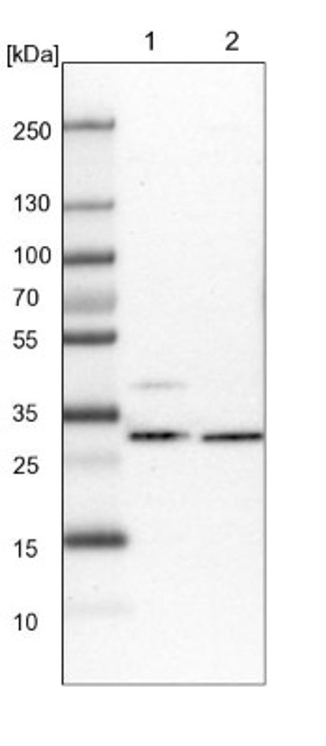 Western Blot: CGI 62 Antibody [NBP1-88246] - Lane 1: NIH-3T3 cell lysate (Mouse embryonic fibroblast cells)<br/>Lane 2: NBT-II cell lysate (Rat Wistar bladder tumour cells)