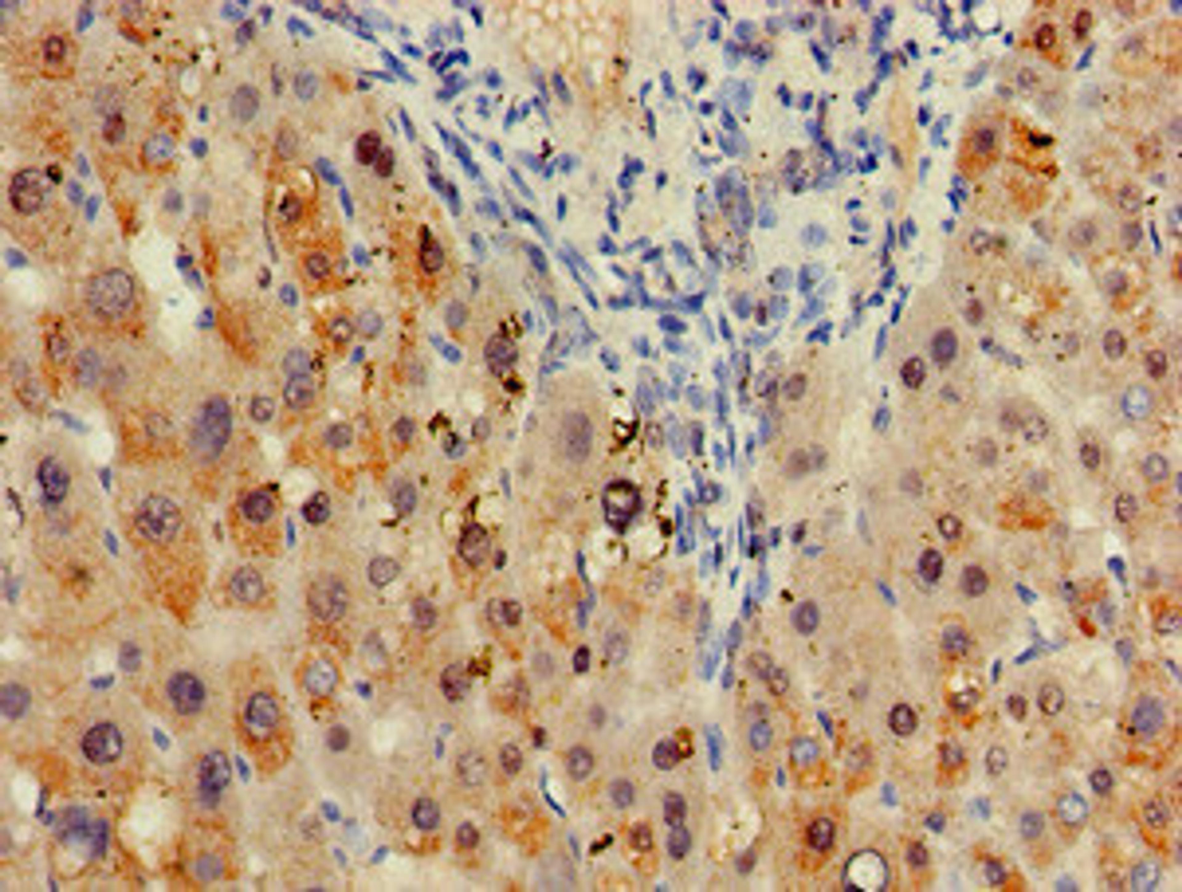 Immunohistochemistry of paraffin-embedded human liver tissue using CSB-PA020893LA01HU at dilution of 1:100