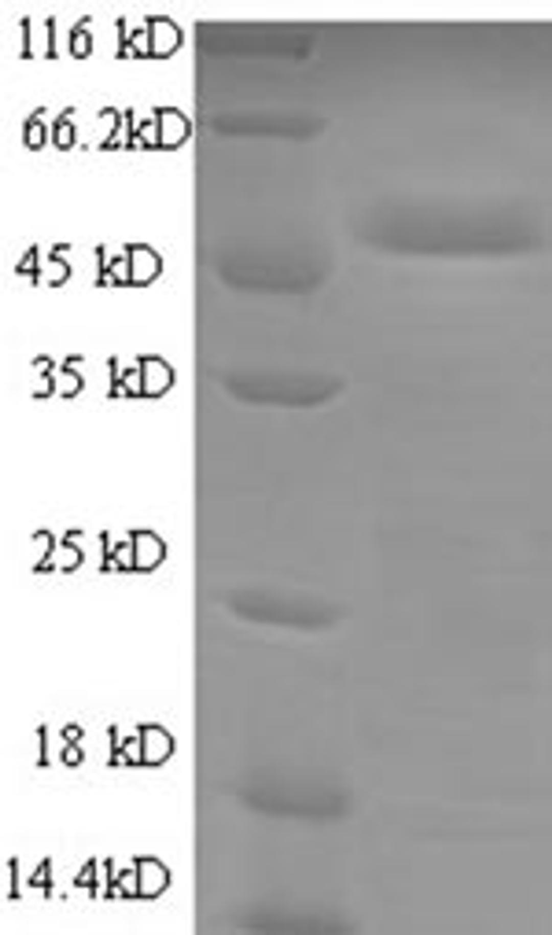 (Tris-Glycine gel) Discontinuous SDS-PAGE (reduced) with 5% enrichment gel and 15% separation gel.