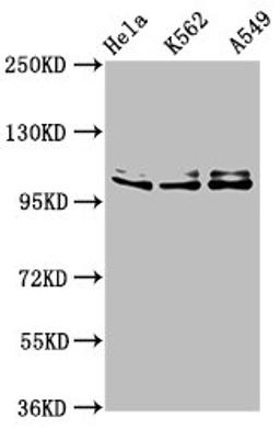 Western Blot. Positive WB detected in: Hela whole cell lysate, K562 whole cell lysate, A549 whole cell lysate. All lanes: XAB2 antibody at 3µg/ml. Secondary. Goat polyclonal to rabbit IgG at 1/50000 dilution. Predicted band size: 101 kDa. Observed band size: 101 kDa