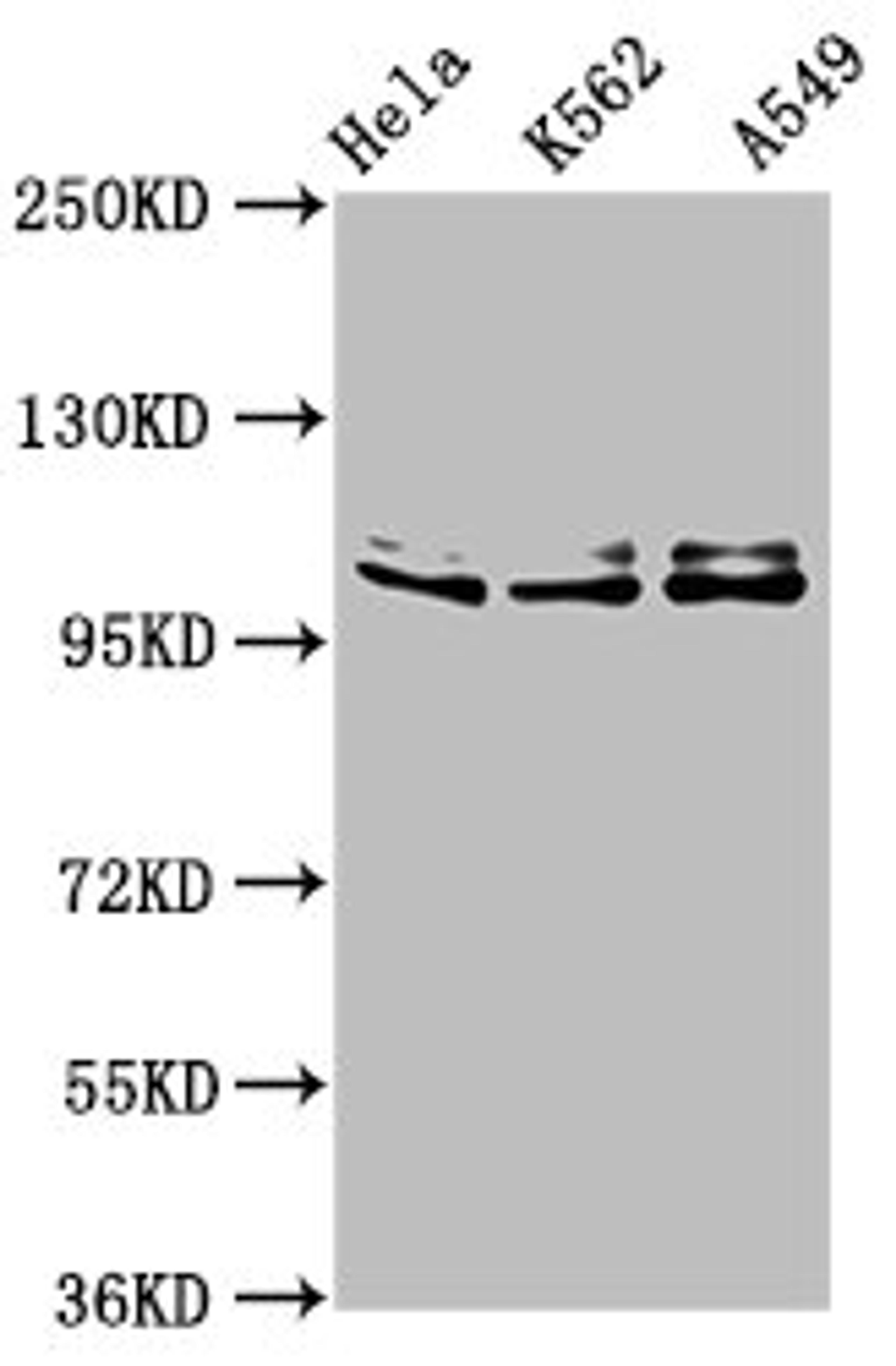 Western Blot. Positive WB detected in: Hela whole cell lysate, K562 whole cell lysate, A549 whole cell lysate. All lanes: XAB2 antibody at 3µg/ml. Secondary. Goat polyclonal to rabbit IgG at 1/50000 dilution. Predicted band size: 101 kDa. Observed band size: 101 kDa