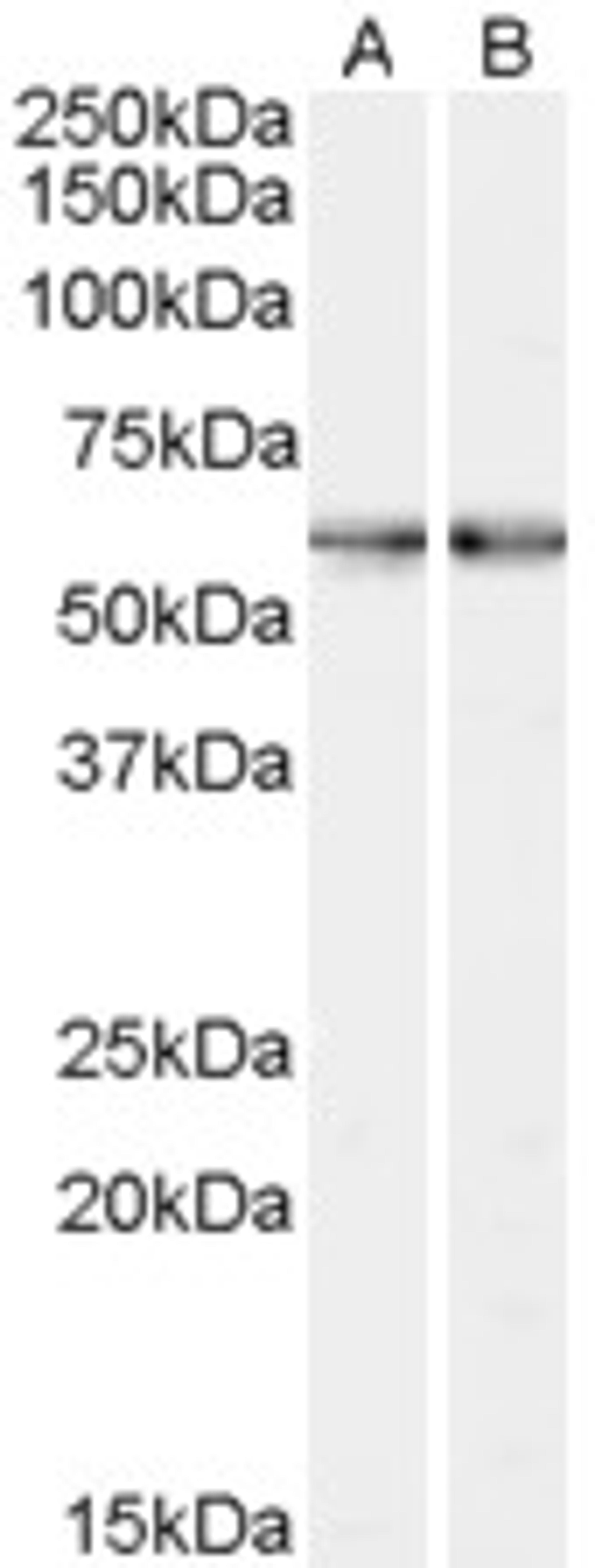 A) 46-388 and B) 46-389 (0.3ug/ml) staining of Human Bone Marrow lysate (35ug protein in RIPA buffer). Primary incubation was 1 hour. Detected by chemiluminescence.