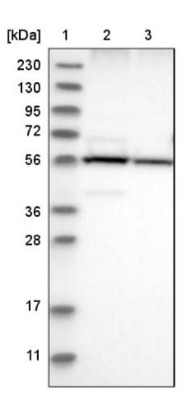 Western Blot: LPCAT1 Antibody [NBP1-88923] - Lane 1: Marker [kDa] 230, 130, 95, 72, 56, 36, 28, 17, 11<br/>Lane 2: Human cell line RT-4<br/>Lane 3: Human cell line U-251MG sp