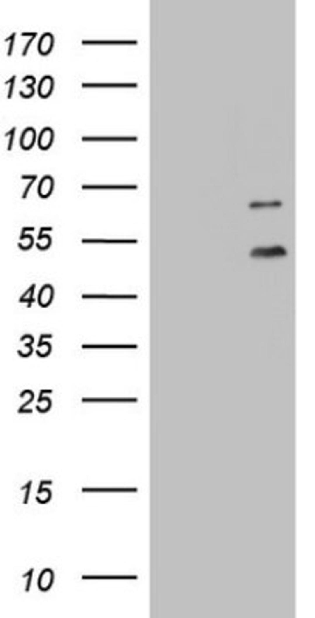 Western Blot: DDOST Antibody (2B4) [NBP2-46439] - Analysis of HEK293T cells were transfected with the pCMV6-ENTRY control (Left lane) or pCMV6-ENTRY DDOST.