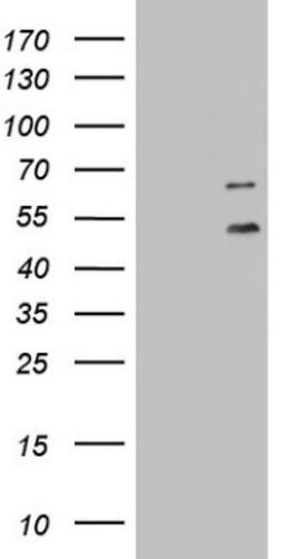 Western Blot: DDOST Antibody (2B4) [NBP2-46439] - Analysis of HEK293T cells were transfected with the pCMV6-ENTRY control (Left lane) or pCMV6-ENTRY DDOST.