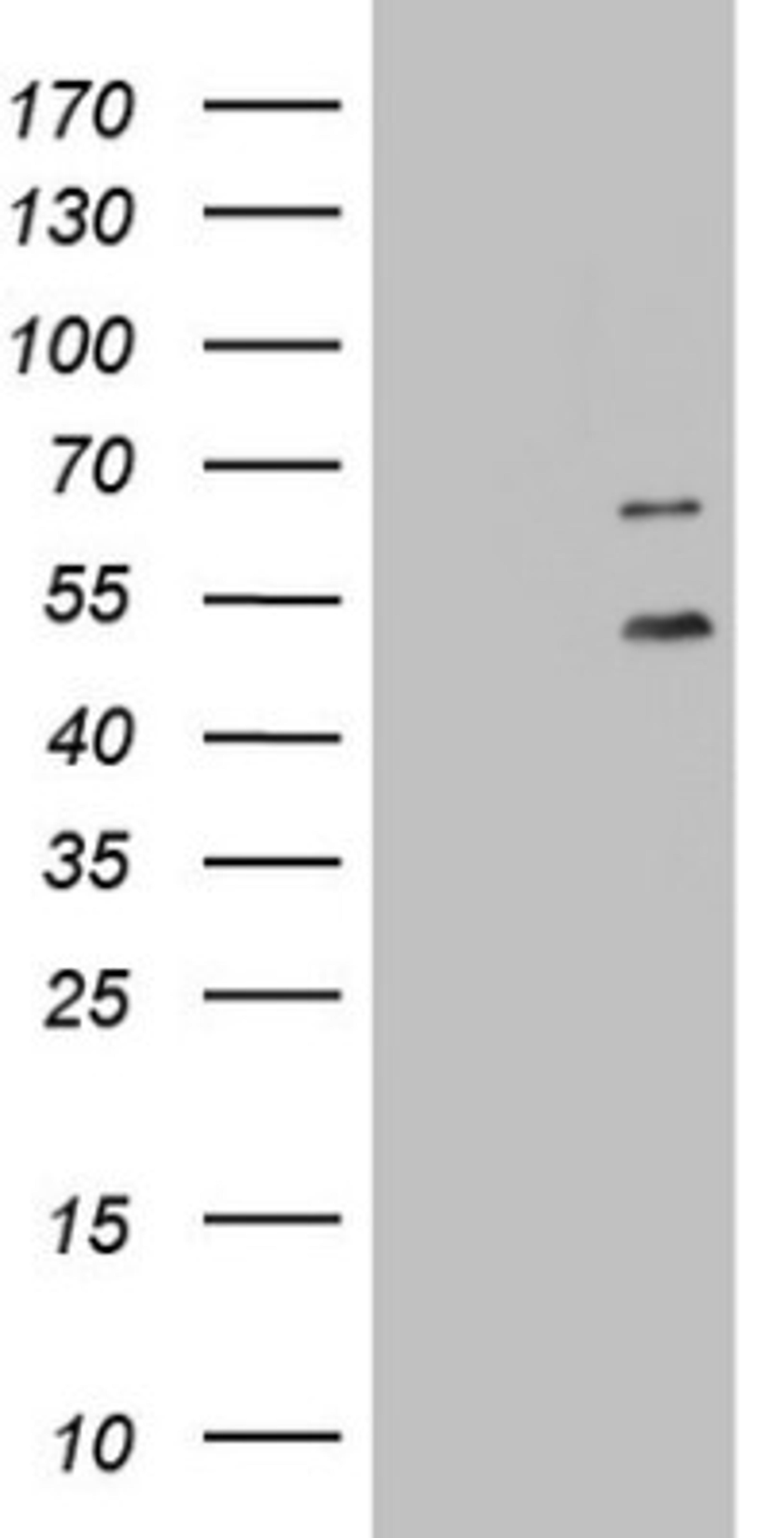 Western Blot: DDOST Antibody (2B4) [NBP2-46439] - Analysis of HEK293T cells were transfected with the pCMV6-ENTRY control (Left lane) or pCMV6-ENTRY DDOST.