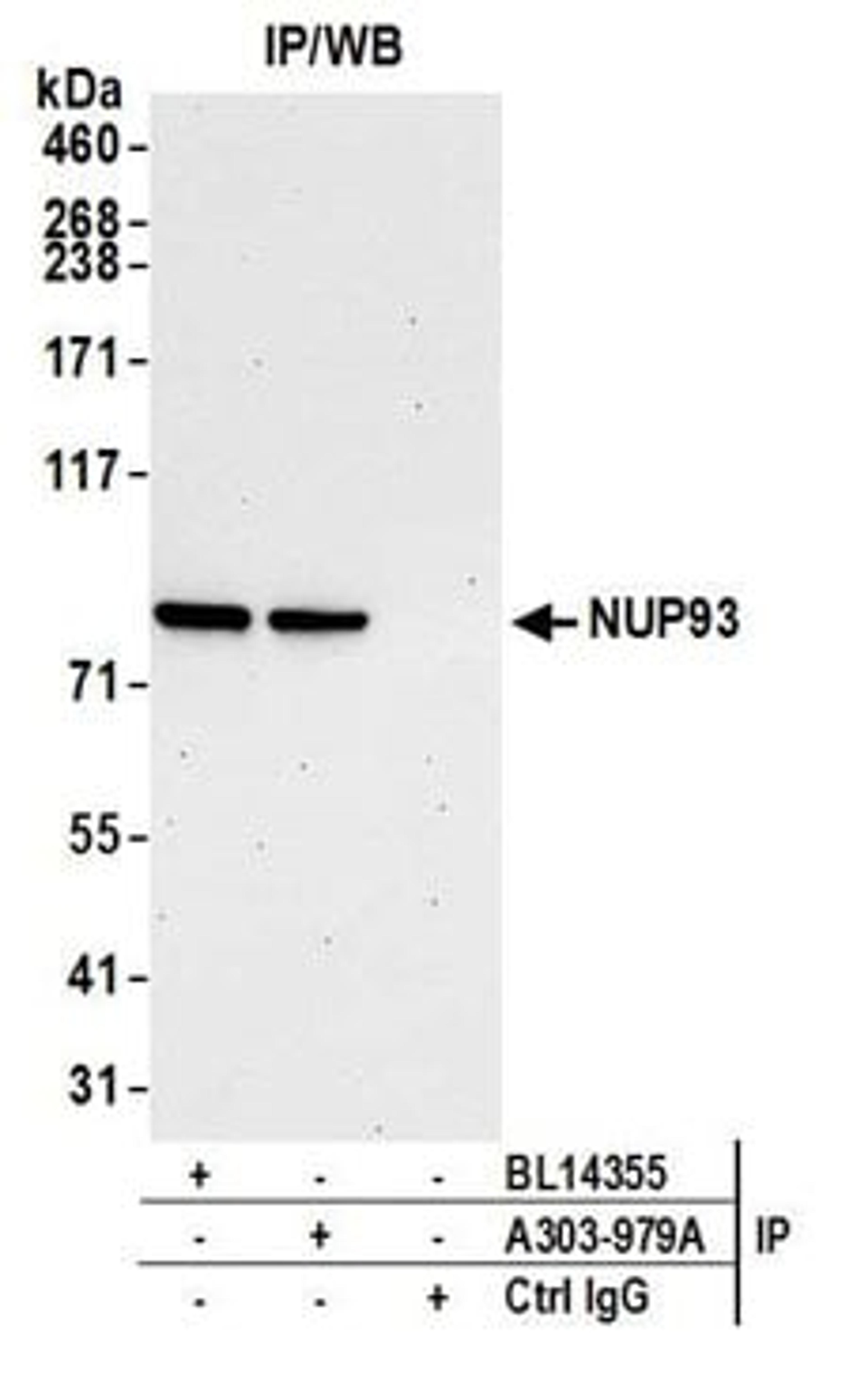 Detection of human NUP93 by western blot of immunoprecipitates.