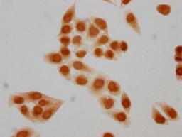 Immunocytochemistry analysis of CSB-PA010403PA05forHU diluted at 1:15 and staining in Hela cells(treated with 30mM sodium butyrate for 4h) performed on a Leica BondTM system. The cells were fixed in 4% formaldehyde, permeabilized using 0.2% Triton X-100 and blocked with 10% normal goat serum 30min at RT. Then primary antibody (1% BSA) was incubated at 4°C overnight. The primary is detected by a biotinylated secondary antibody and visualized using an HRP conjugated SP system.
