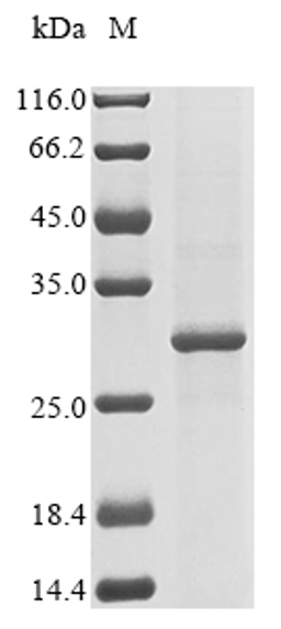 (Tris-Glycine gel) Discontinuous SDS-PAGE (reduced) with 5% enrichment gel and 15% separation gel.