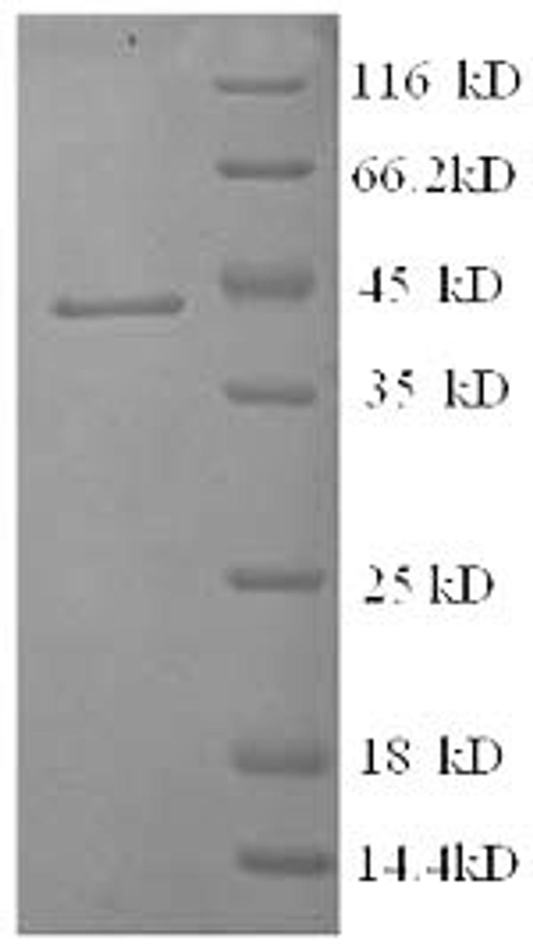 (Tris-Glycine gel) Discontinuous SDS-PAGE (reduced) with 5% enrichment gel and 15% separation gel.