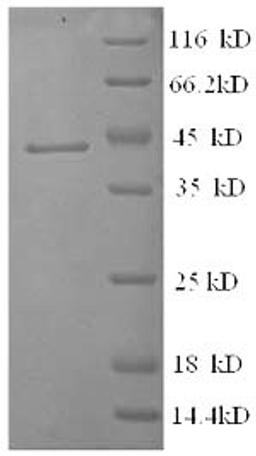 (Tris-Glycine gel) Discontinuous SDS-PAGE (reduced) with 5% enrichment gel and 15% separation gel.