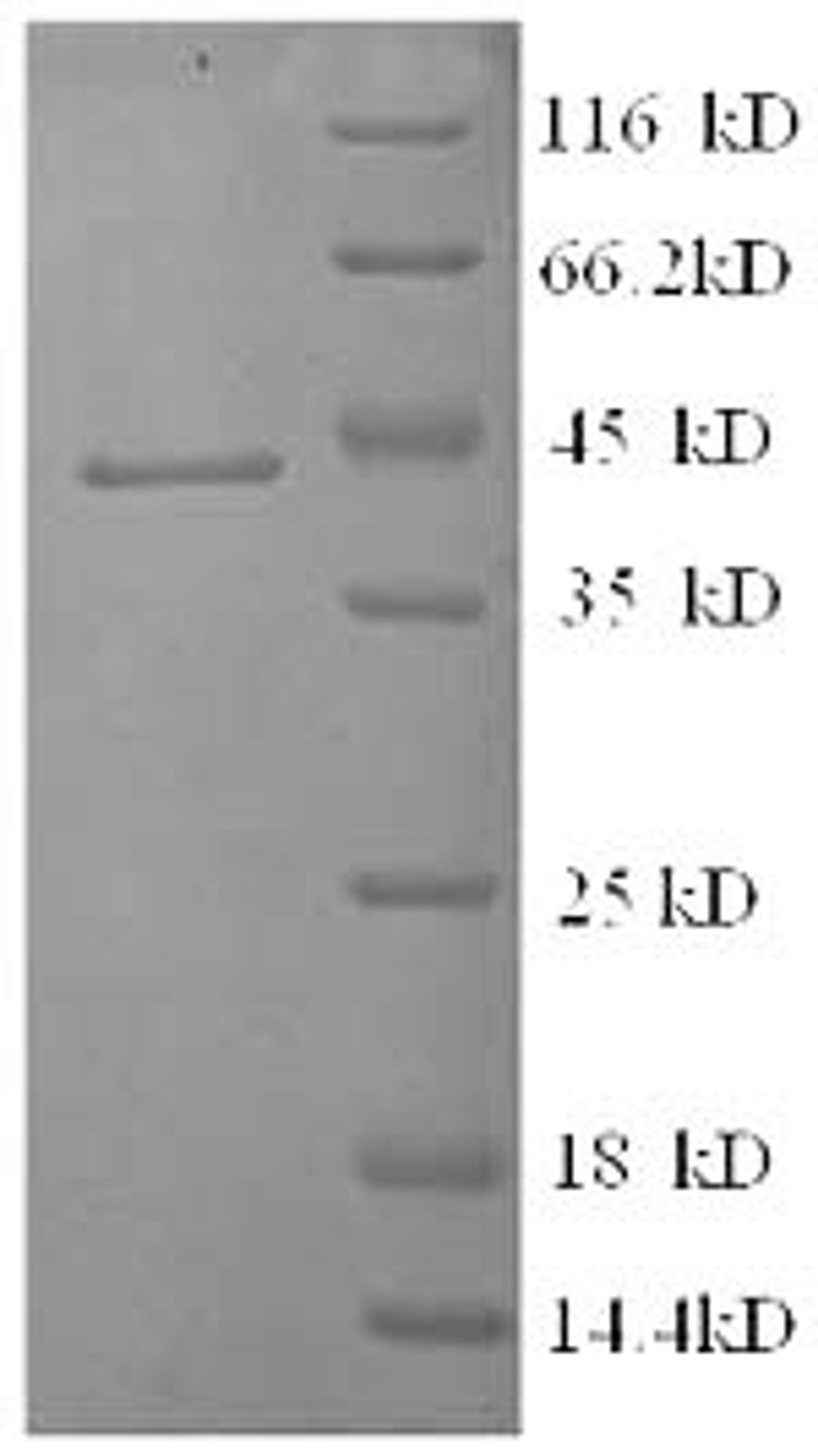 (Tris-Glycine gel) Discontinuous SDS-PAGE (reduced) with 5% enrichment gel and 15% separation gel.