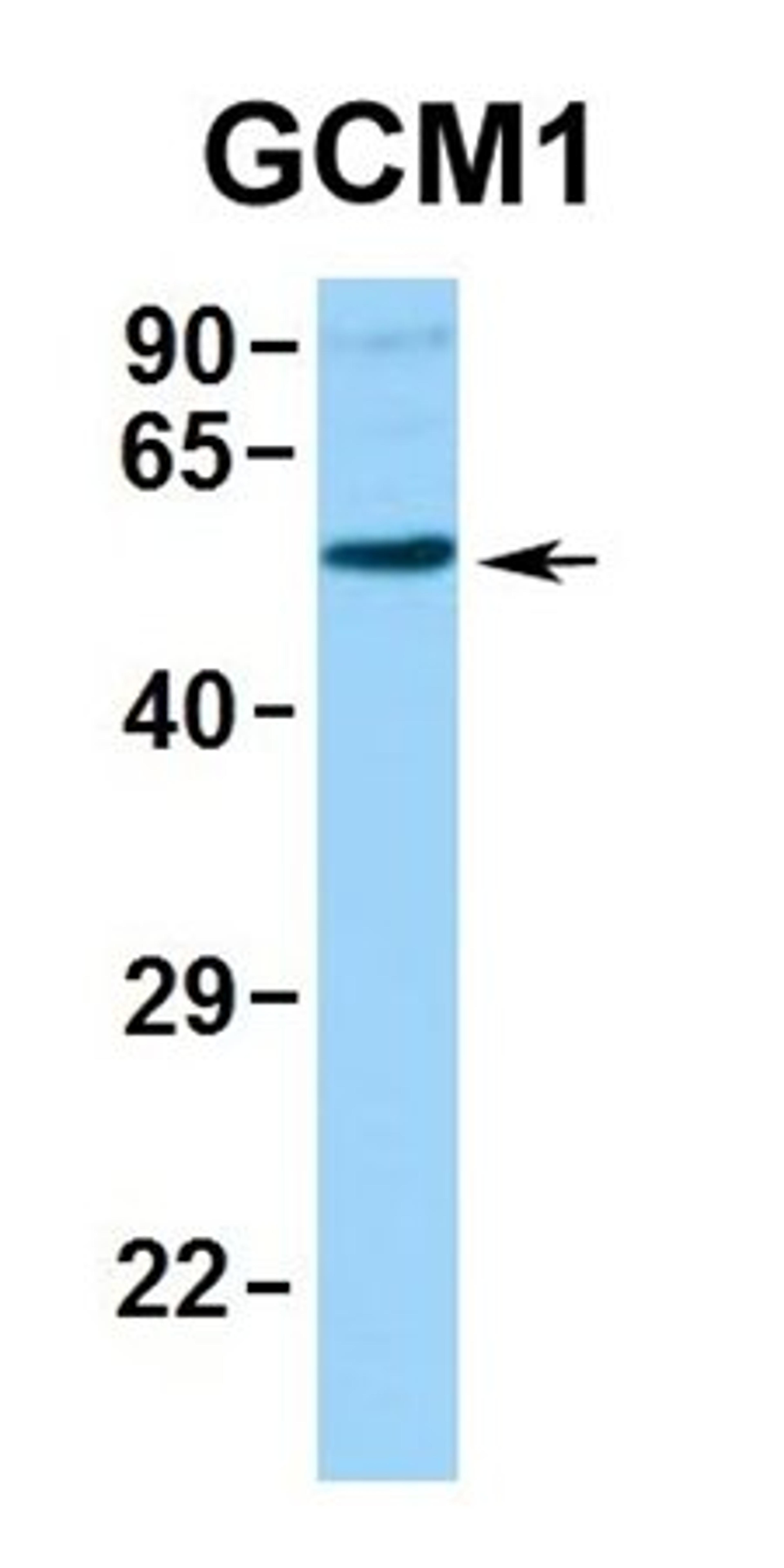 Western blot analysis of human 293T tissue using GCM1 antibody