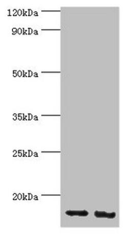 Western blot. All lanes: E3 ubiquitin-protein ligase RBX1 antibody at 4ug/ml. Lane 1: Hela whole cell lysate. Lane 2: HepG2 whole cell lysate. Secondary. Goat polyclonal to rabbit IgG at 1/10000 dilution. Predicted band size: 12 kDa. Observed band size: 12 kDa. 