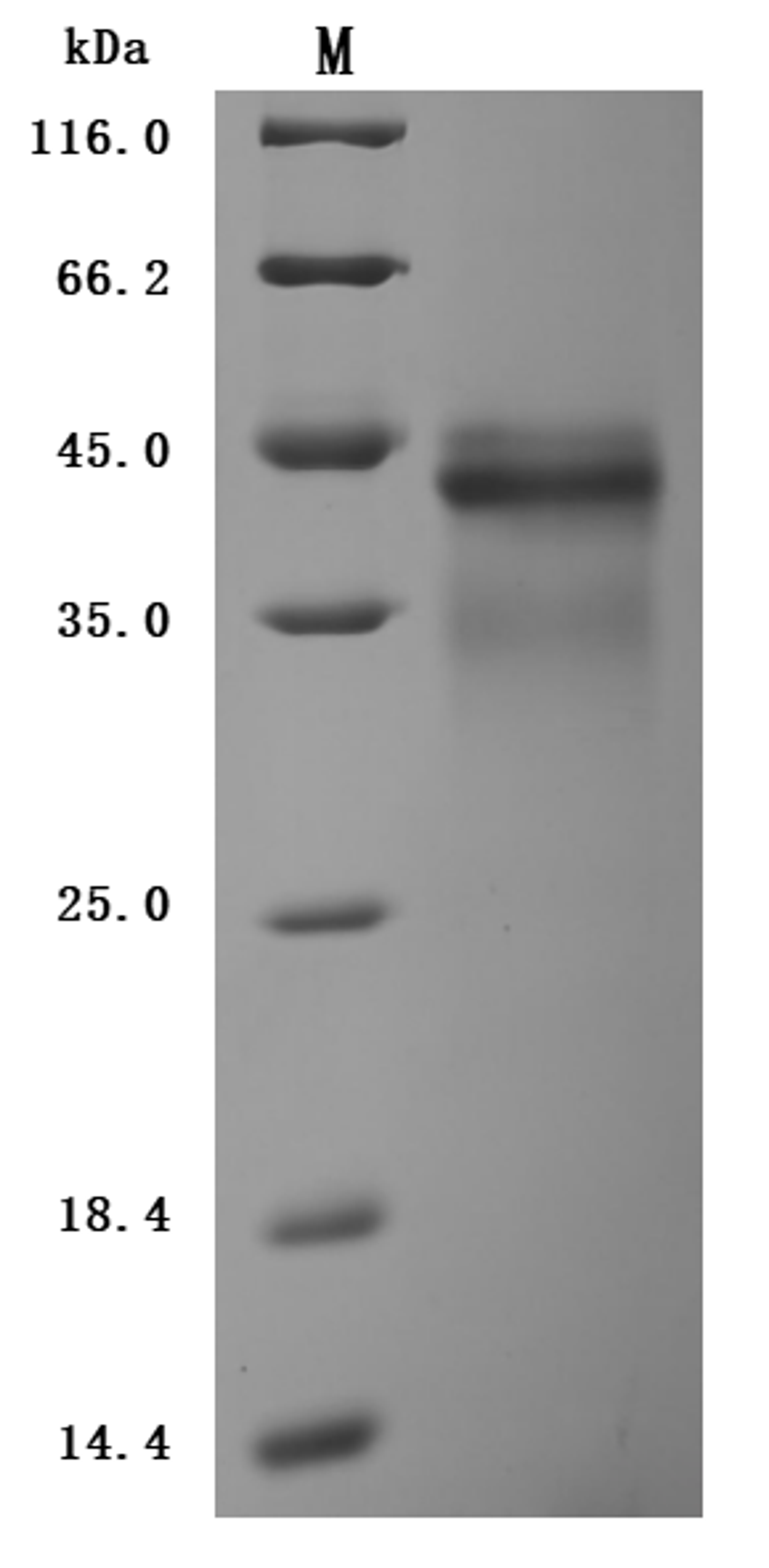 (Tris-Glycine gel) Discontinuous SDS-PAGE (reduced) with 5% enrichment gel and 15% separation gel.