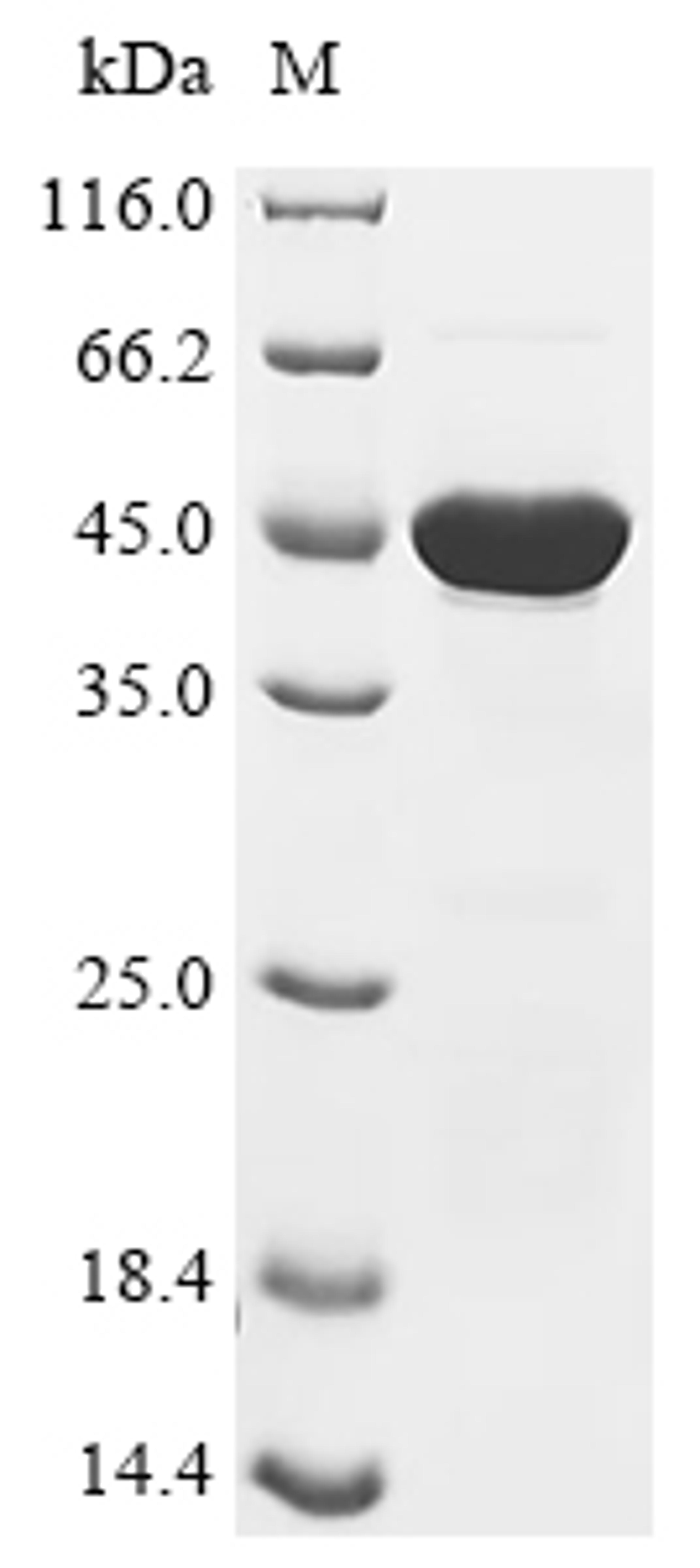 (Tris-Glycine gel) Discontinuous SDS-PAGE (reduced) with 5% enrichment gel and 15% separation gel.