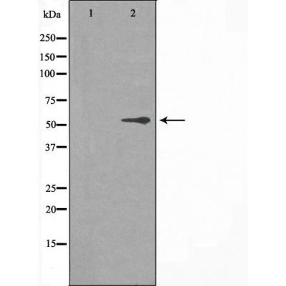 Western blot analysis of HT-29 cells using 2R1 (Cytochrome P450) antibody