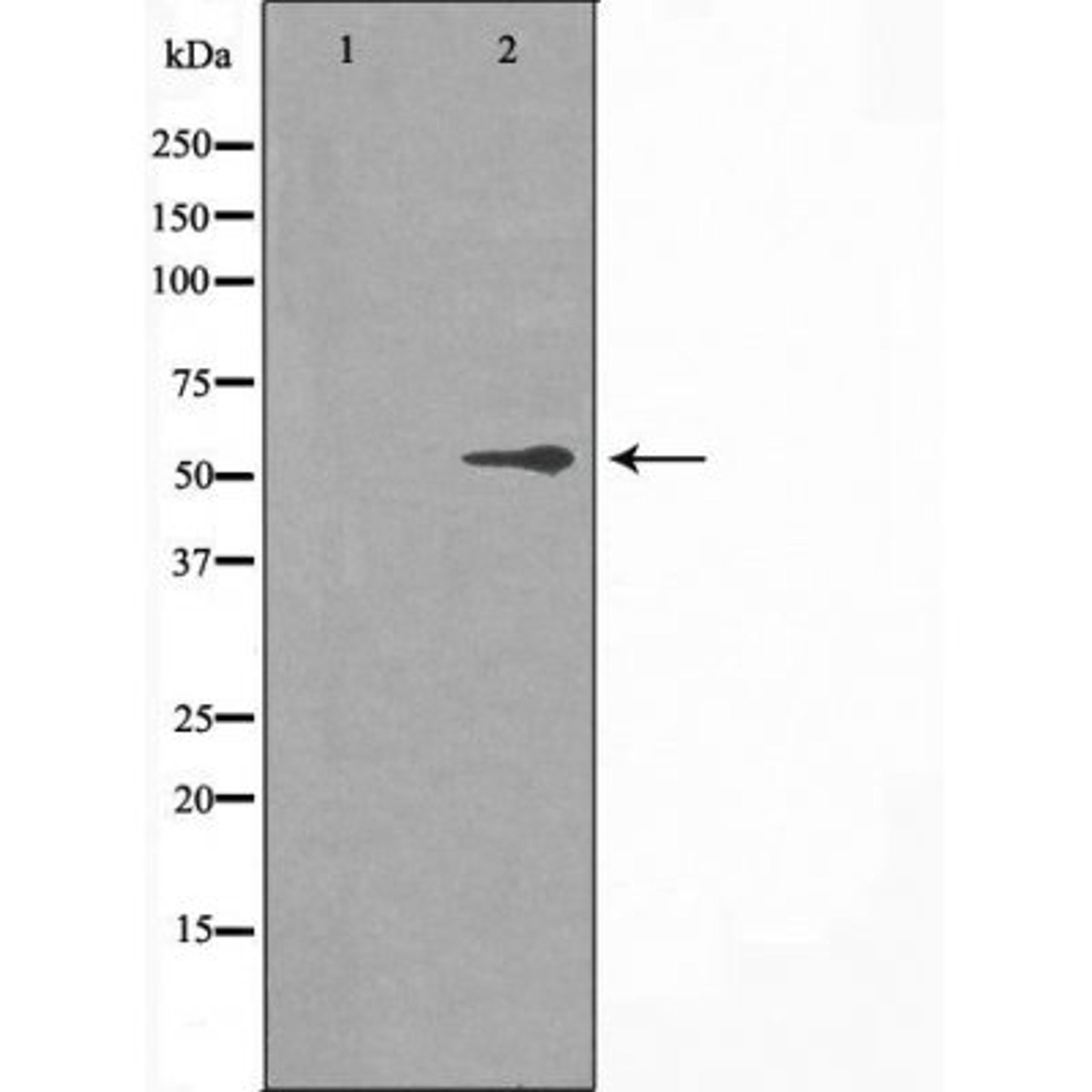 Western blot analysis of HT-29 cells using 2R1 (Cytochrome P450) antibody