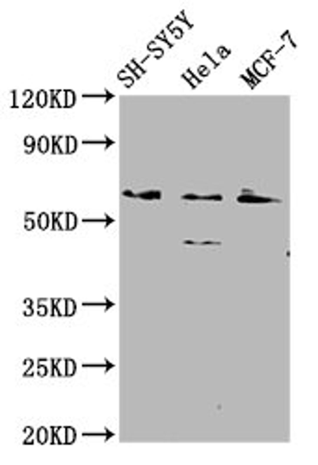 Western Blot. Positive WB detected in: SH-SY5Y whole cell lysate, Hela whole cell lysate, MCF-7 whole cell lysate. All lanes: RANBP10 antibody at 2.1µg/ml. Secondary. Goat polyclonal to rabbit IgG at 1/50000 dilution. Predicted band size: 68, 59, 65 kDa. Observed band size: 68 kDa