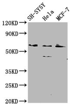 Western Blot. Positive WB detected in: SH-SY5Y whole cell lysate, Hela whole cell lysate, MCF-7 whole cell lysate. All lanes: RANBP10 antibody at 2.1µg/ml. Secondary. Goat polyclonal to rabbit IgG at 1/50000 dilution. Predicted band size: 68, 59, 65 kDa. Observed band size: 68 kDa