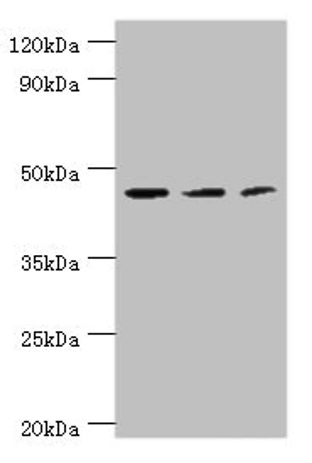 Western blot. All lanes: ACY1 antibody at 4µg/ml. Lane 1: K562 whole cell lysate. Lane 2: HepG2 whole cell lysate. Lane 3: Mouse kidney tissue. Secondary. Goat polyclonal to rabbit IgG at 1/10000 dilution. Predicted band size: 46, 38, 39, 43 kDa. Observed band size: 46 kDa