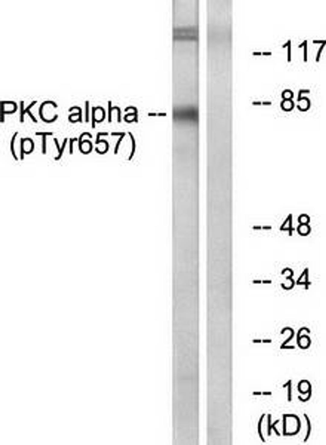 Western blot analysis of extracts from COLO205 cells using PKC alpha (phospho-Tyr657) antibody