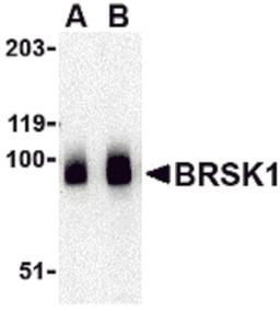 Western blot analysis of BRSK1 in human brain tissue lysate with BRSK1 antibody at (A) 0.5 and (B) 1 μg/mL.