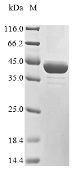 (Tris-Glycine gel) Discontinuous SDS-PAGE (reduced) with 5% enrichment gel and 15% separation gel.