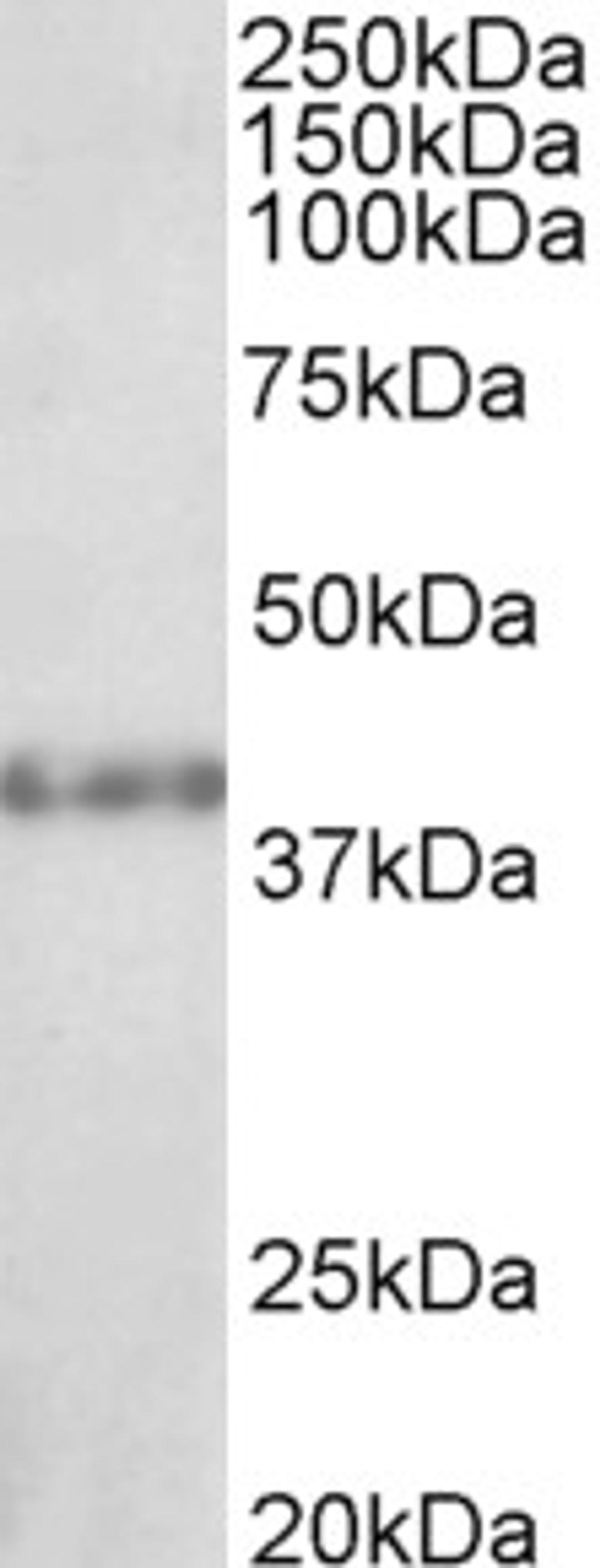 46-451 (1ug/ml) staining of Rat Kidney lysate (35ug protein in RIPA buffer). Primary incubation was 1 hour. Detected by chemiluminescence.