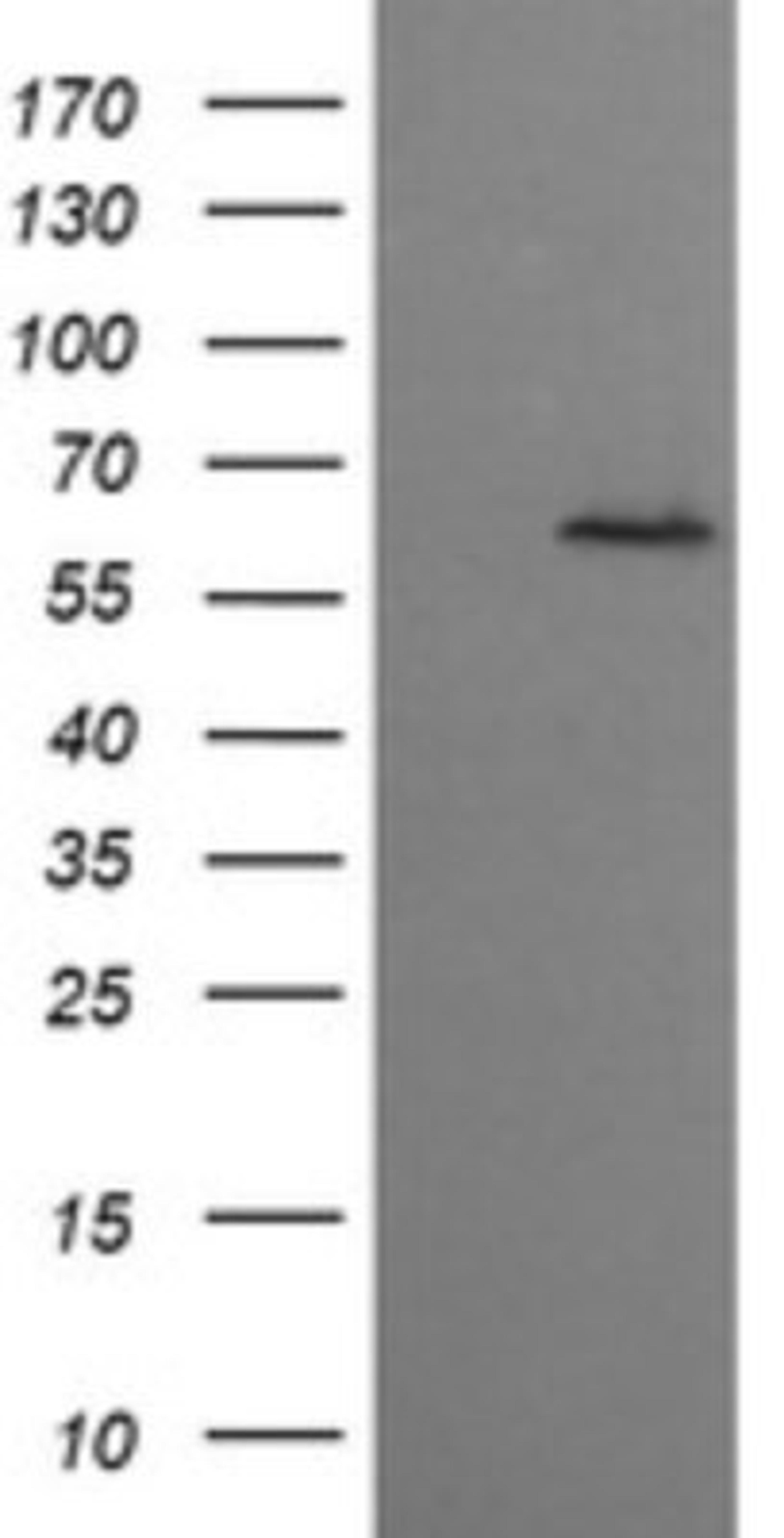 Western Blot: CESK1 Antibody (1C1) [NBP2-46114] - Analysis of HEK293T cells were transfected with the pCMV6-ENTRY control (Left lane) or pCMV6-ENTRY CESK1.