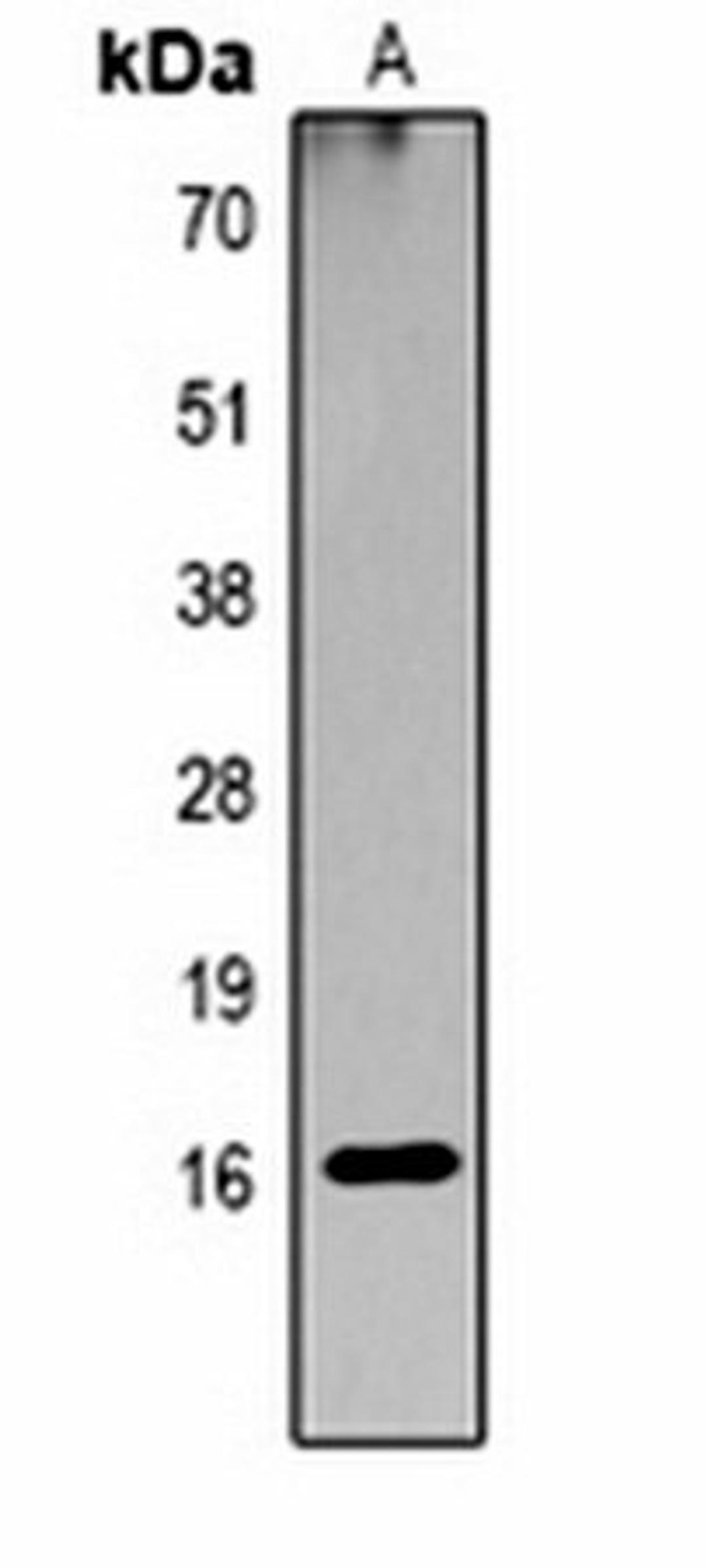 Western blot analysis of  Hela TSA-treated (Lane1) whole cell lysates using Histone H3 (AcK23) antibody