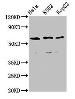 Western Blot. Positive WB detected in: Hela whole cell lysate, K562 whole cell lysate, HepG2 whole cell lysate. All lanes: CCT5 antibody at 4µg/ml. Secondary. Goat polyclonal to rabbit IgG at 1/50000 dilution. Predicted band size: 60, 50 kDa. Observed band size: 60 kDa