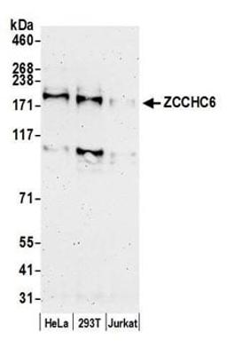 Detection of human ZCCHC6 by western blot.