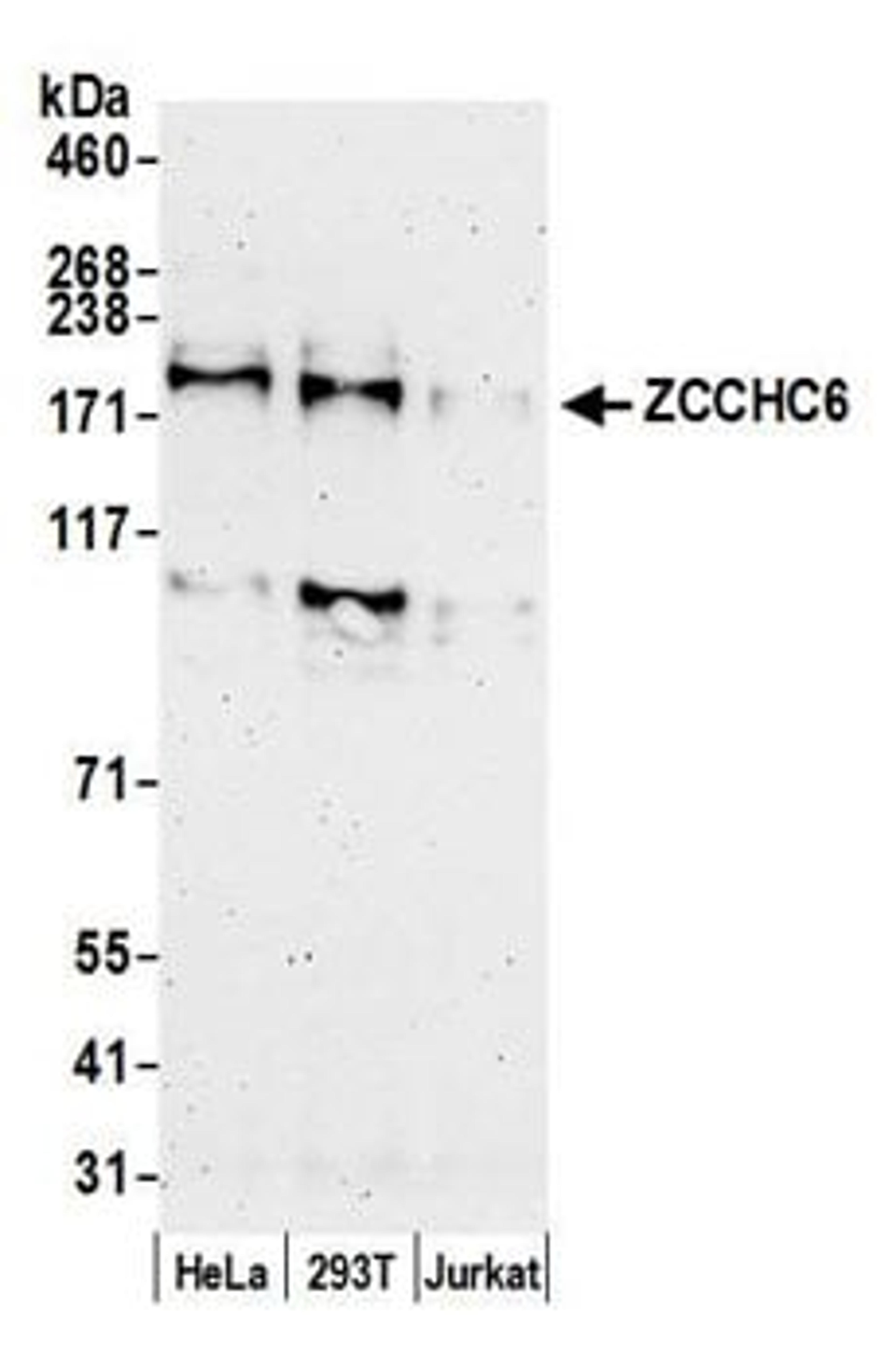 Detection of human ZCCHC6 by western blot.