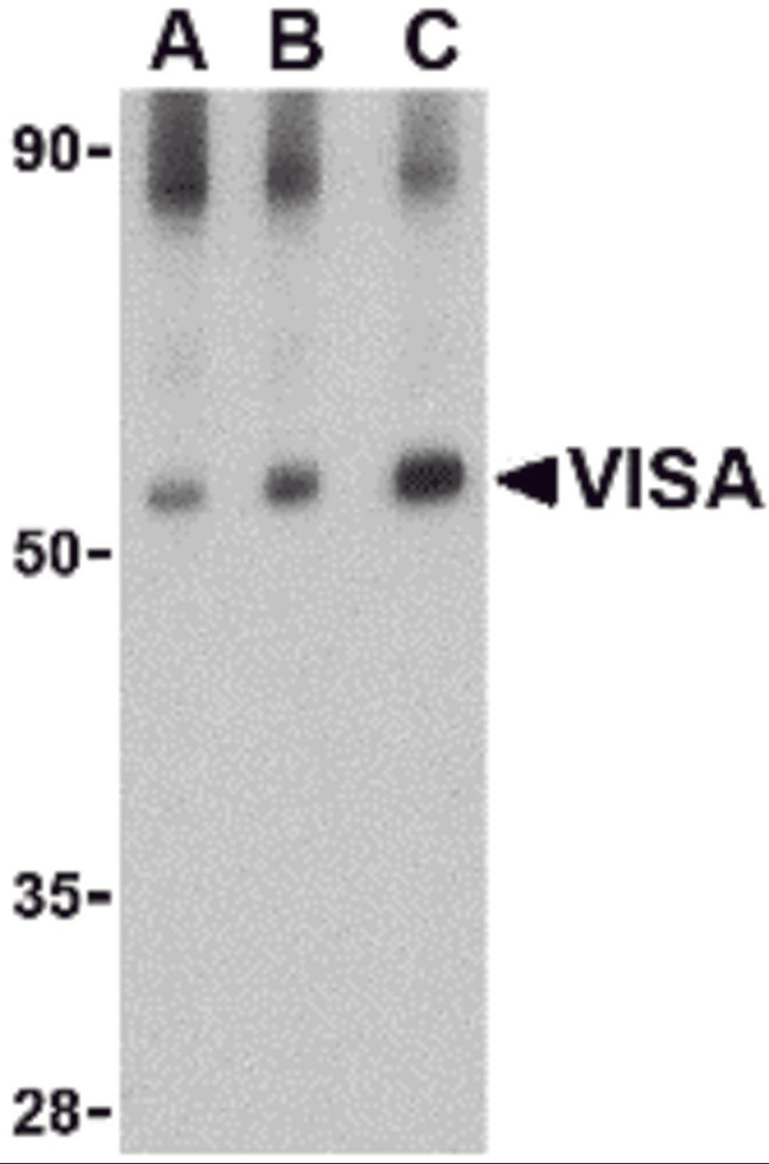 Western blot analysis of VISA in rat brain tissue lysate with VISA antibody at (A) 0.5, (B) 1 and (C) 2 &#956;g/mL.