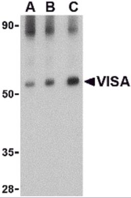 Western blot analysis of VISA in rat brain tissue lysate with VISA antibody at (A) 0.5, (B) 1 and (C) 2 μg/mL.