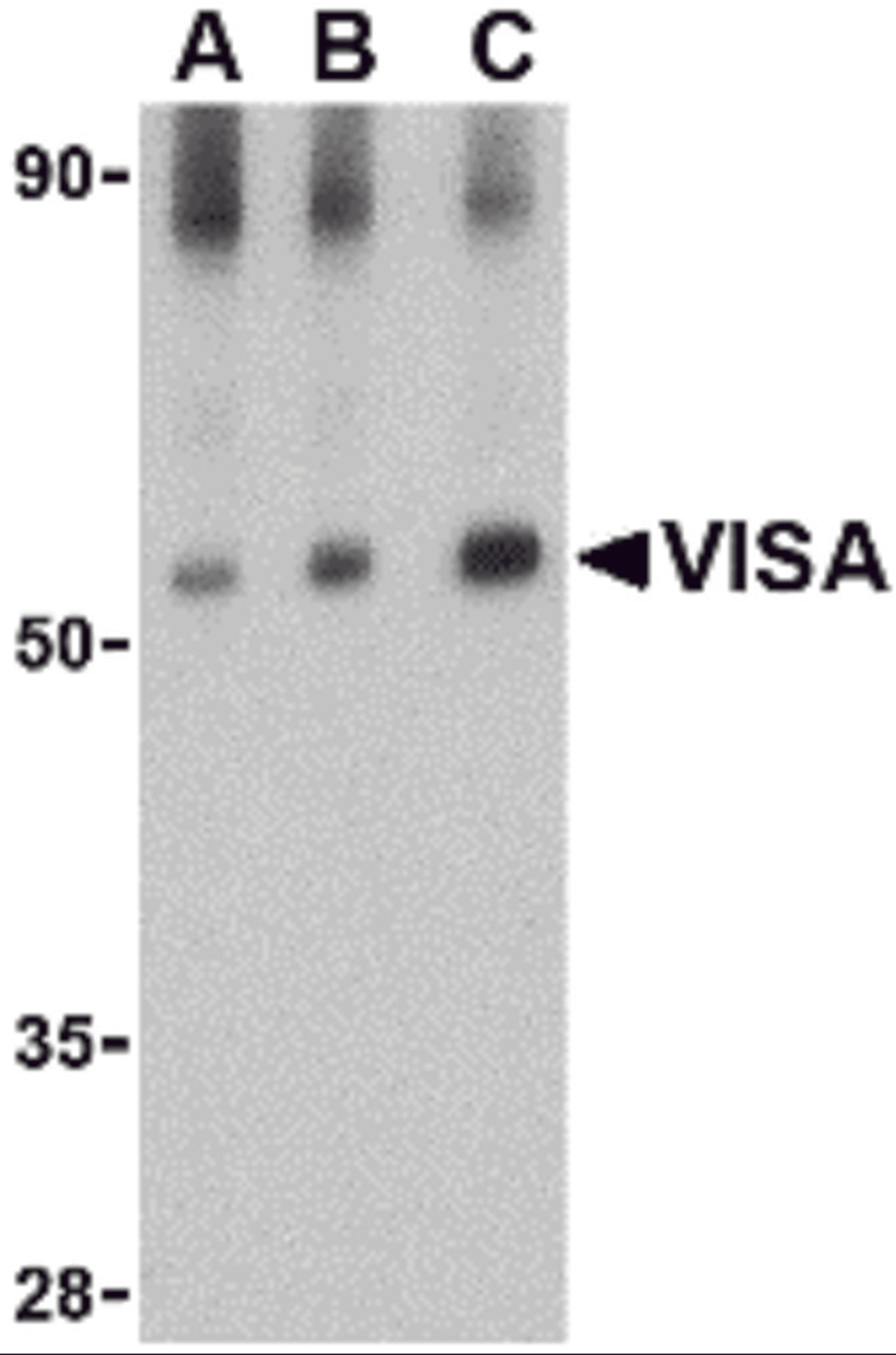 Western blot analysis of VISA in rat brain tissue lysate with VISA antibody at (A) 0.5, (B) 1 and (C) 2 μg/mL.