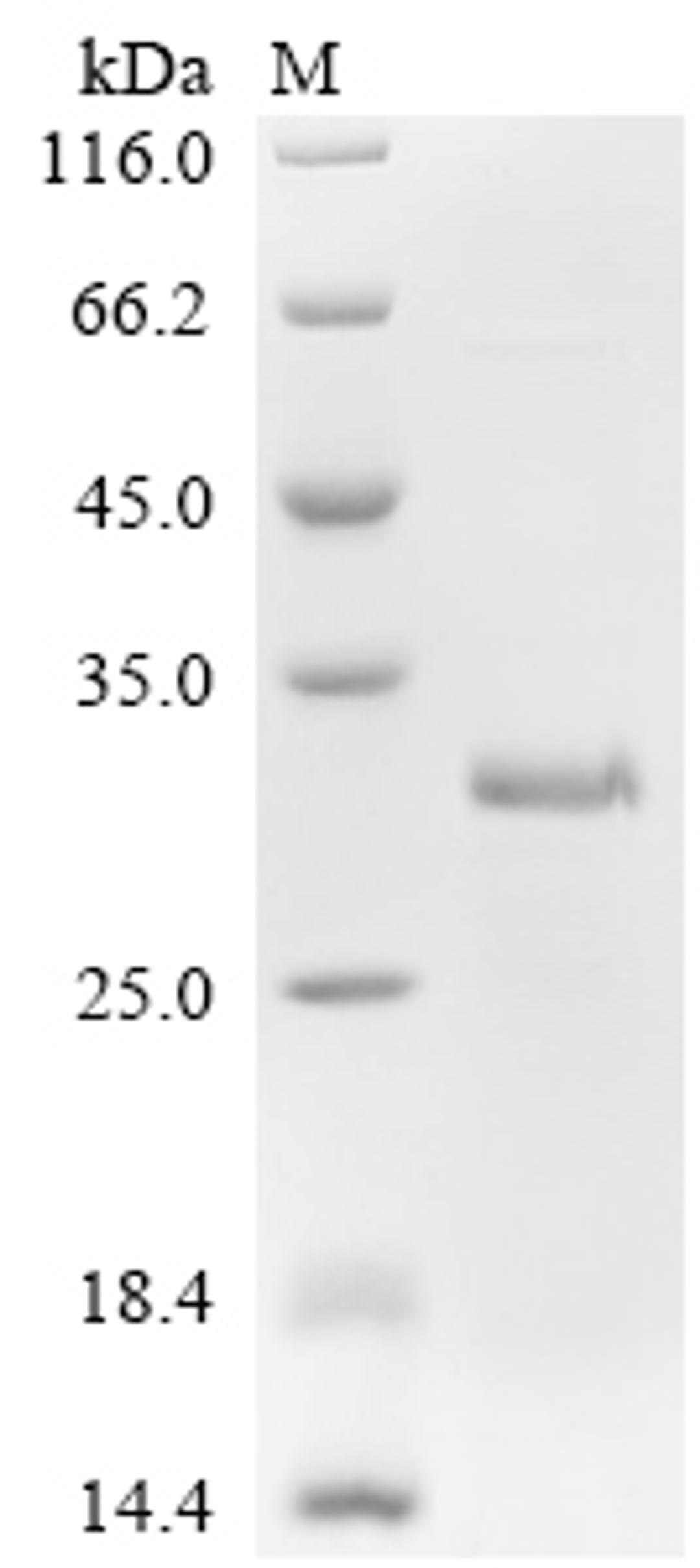 (Tris-Glycine gel) Discontinuous SDS-PAGE (reduced) with 5% enrichment gel and 15% separation gel.