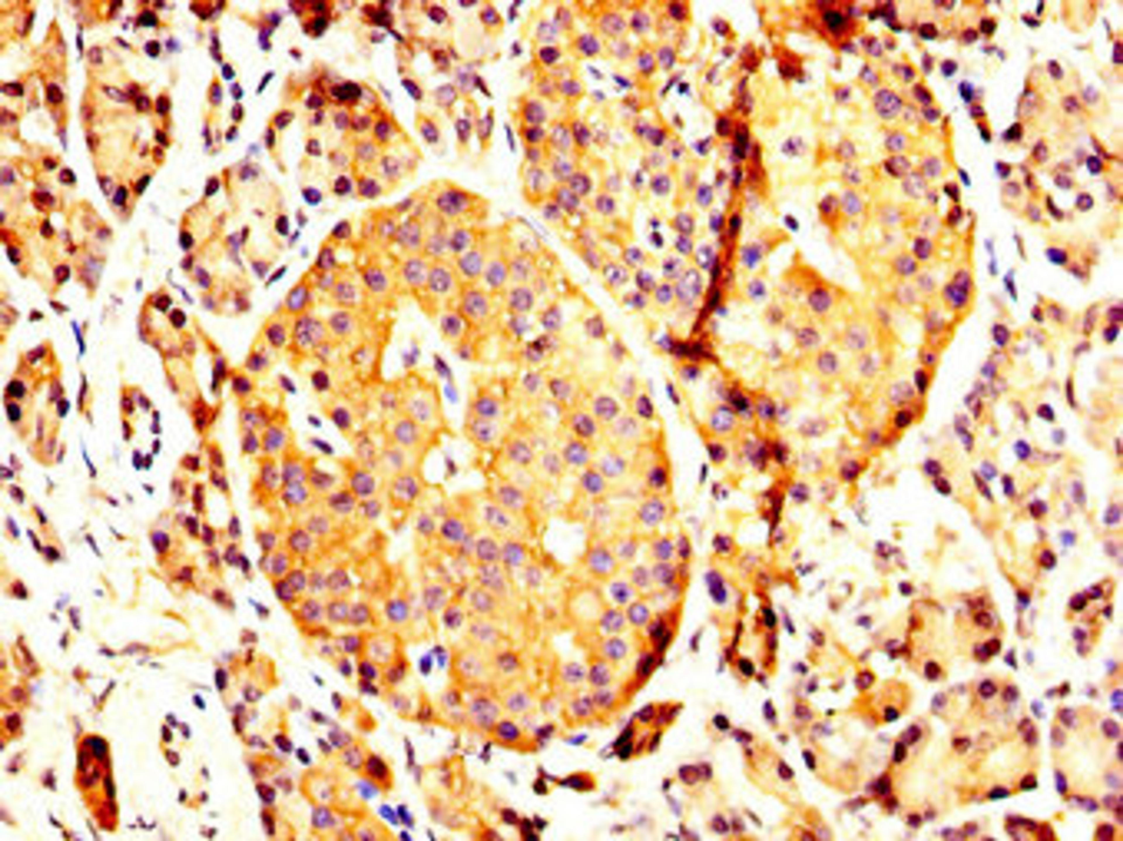 IHC image of CSB-PA017618LA01HU diluted at 1:200 and staining in paraffin-embedded human pancreatic tissue performed on a Leica BondTM system. After dewaxing and hydration, antigen retrieval was mediated by high pressure in a citrate buffer (pH 6.0). Section was blocked with 10% normal goat serum 30min at RT. Then primary antibody (1% BSA) was incubated at 4°C overnight. The primary is detected by a biotinylated secondary antibody and visualized using an HRP conjugated SP system.