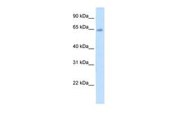 Antibody used in WB on Human Placenta at 5.0 ug/ml.