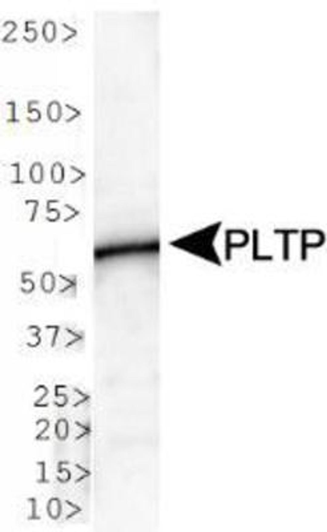 Western Blot: PLTP Antibody [NB400-106] - WB analysis of PLTP in human brain lysate.