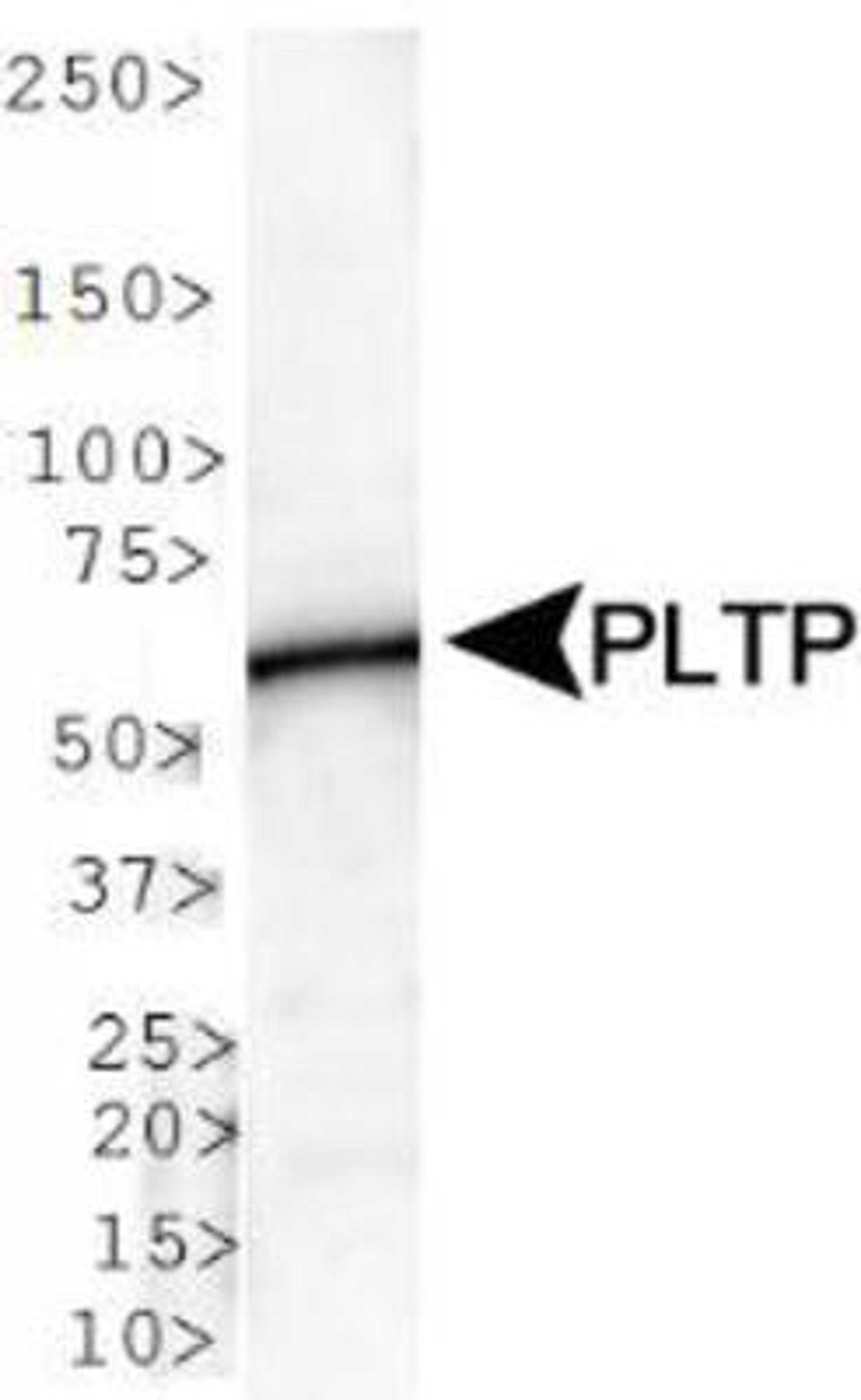 Western Blot: PLTP Antibody [NB400-106] - WB analysis of PLTP in human brain lysate.