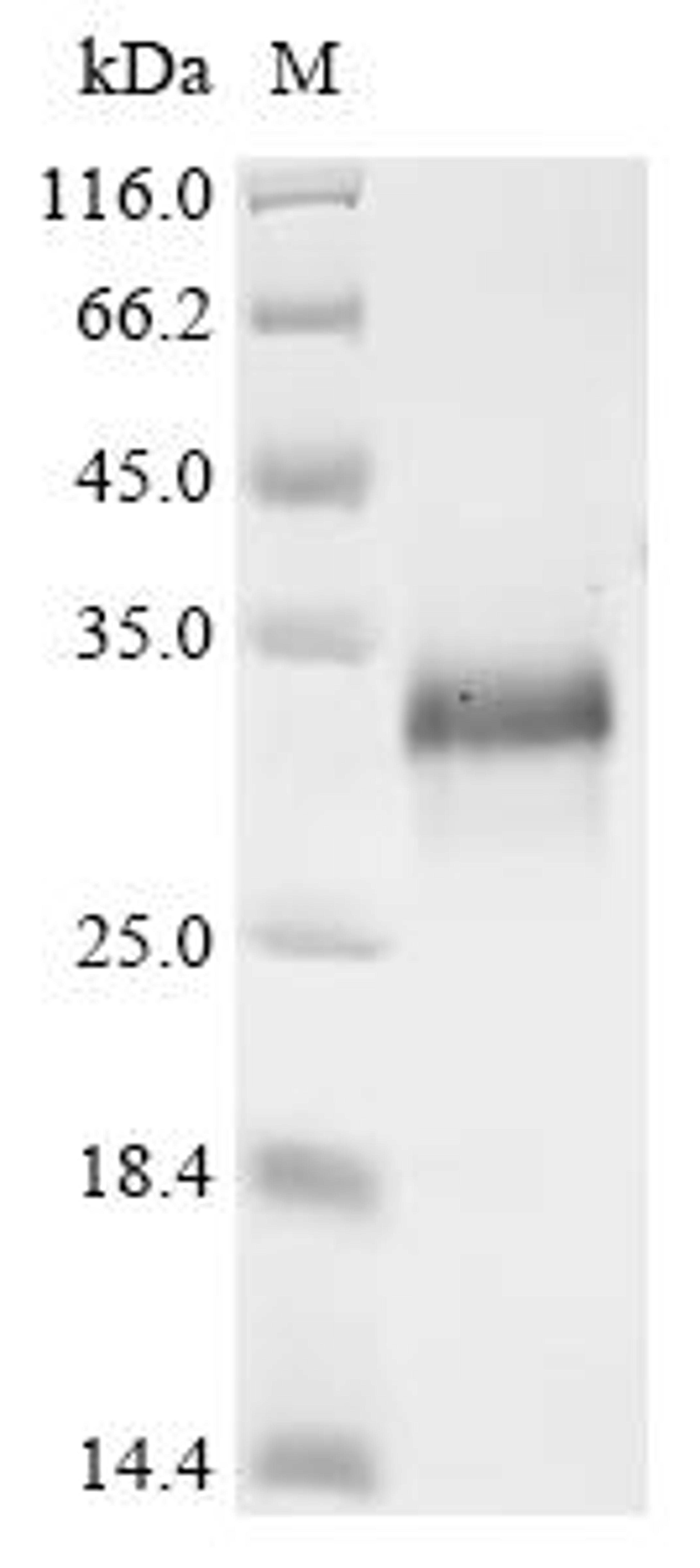 (Tris-Glycine gel) Discontinuous SDS-PAGE (reduced) with 5% enrichment gel and 15% separation gel.