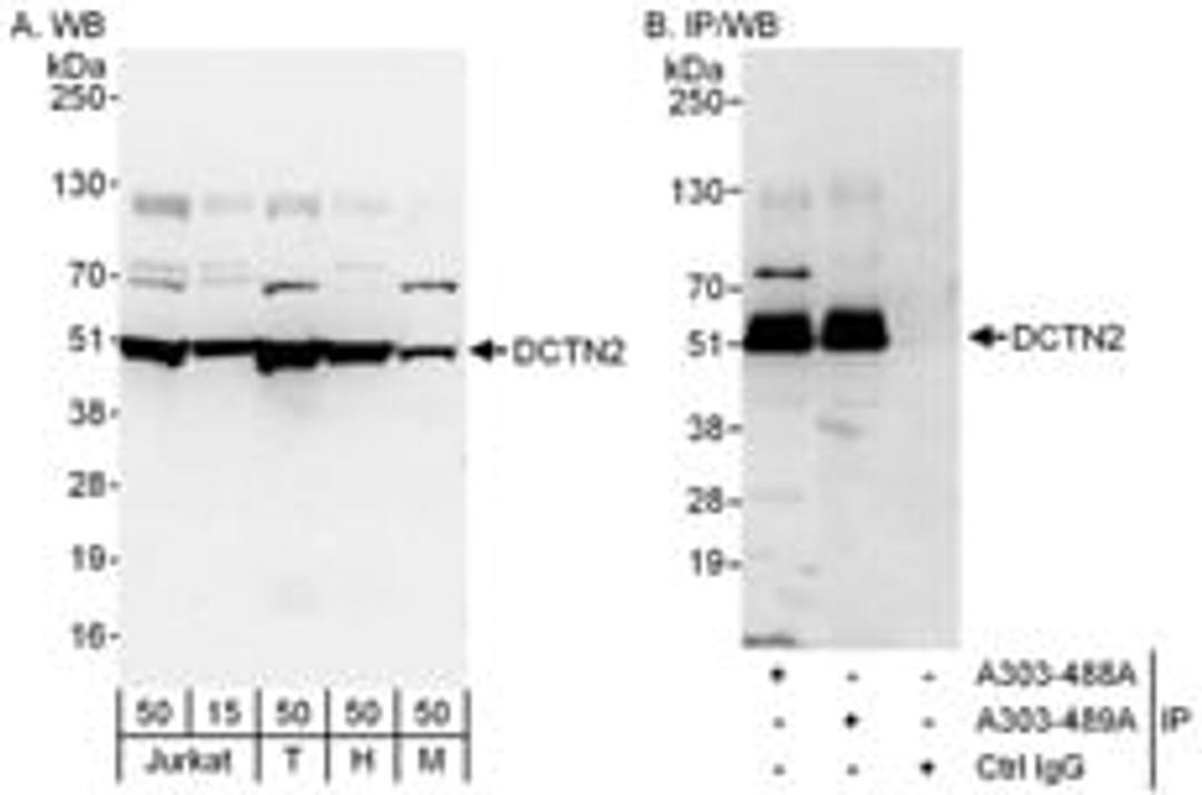 Detection of human and mouse DCTN2 by western blot (h and m) and immunoprecipitation (h).