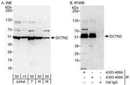 Detection of human and mouse DCTN2 by western blot (h and m) and immunoprecipitation (h).