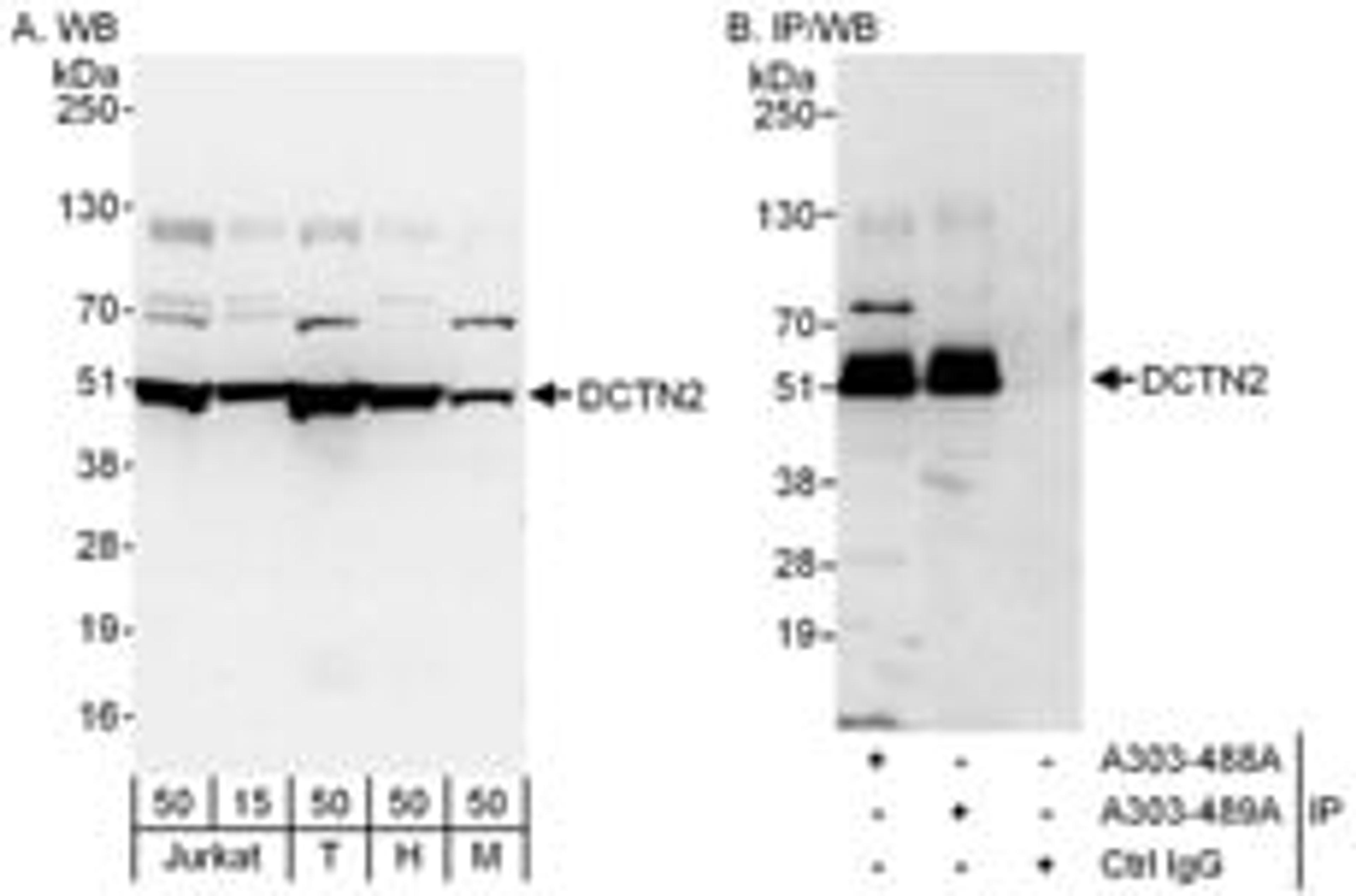 Detection of human and mouse DCTN2 by western blot (h and m) and immunoprecipitation (h).