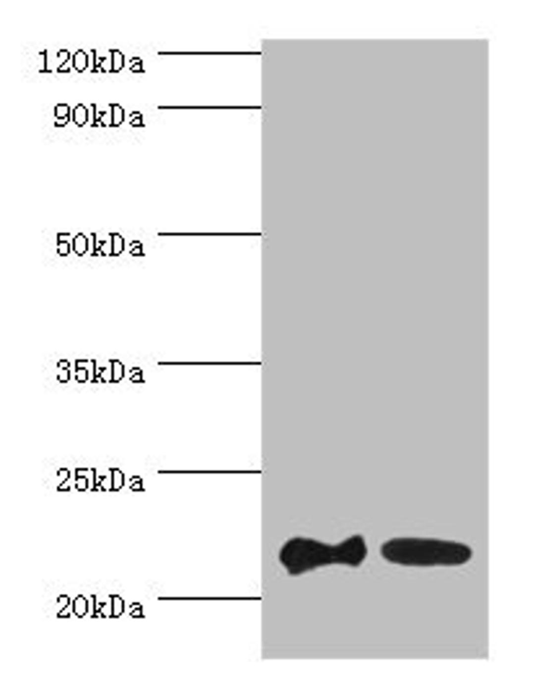 Western blot. All lanes: SRI antibody at 2µg/ml. Lane 1: HepG2 whole cell lysate. Lane 2: Hela whole cell lysate. Secondary. Goat polyclonal to rabbit at 1/10000 dilution. Predicted band size: 22, 21 kDa. Observed band size: 22 kDa