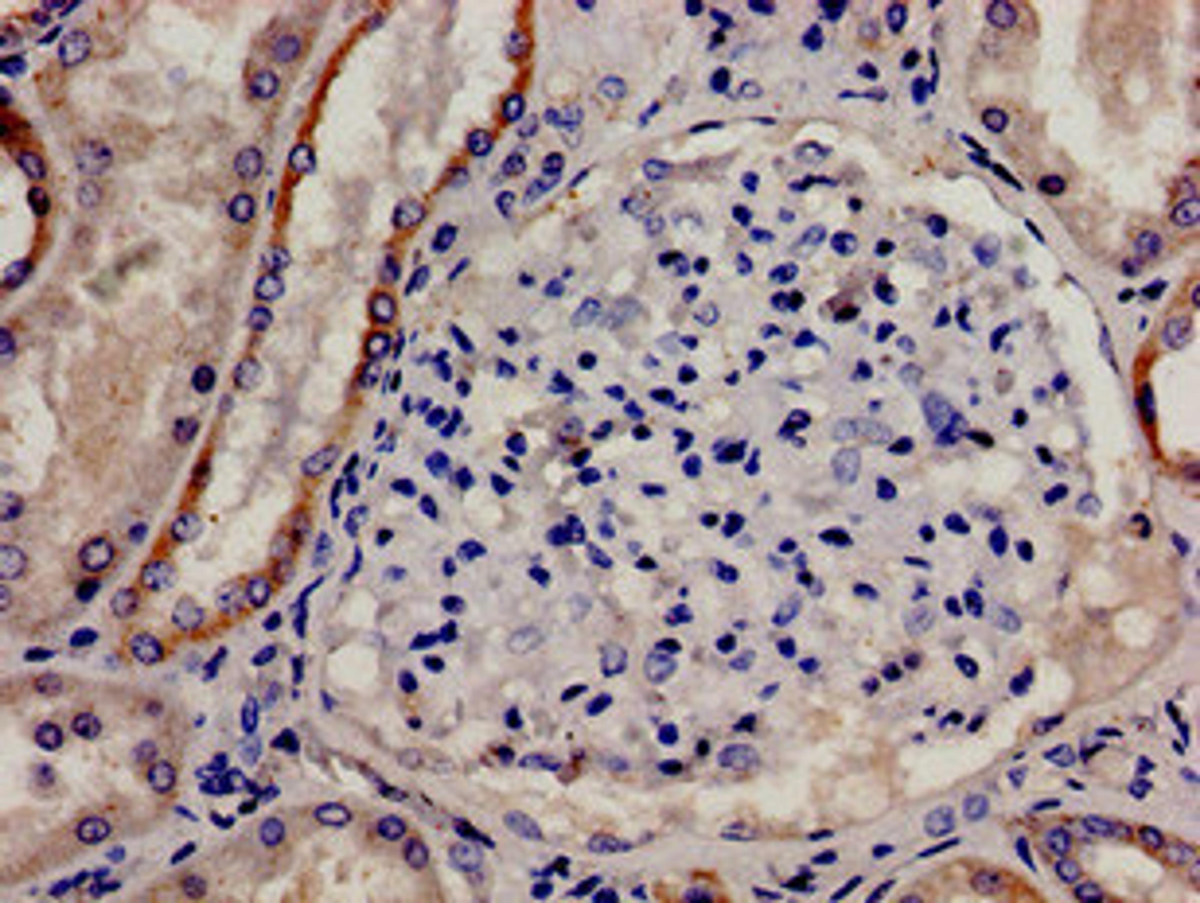 Immunohistochemistry analysis of human kidney tissue using CSB-PA006040LA01HU at dilution of 1:100